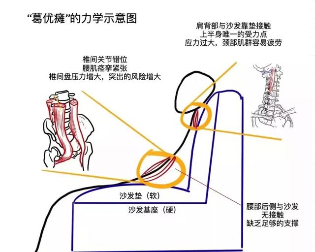 只需要一部手机_腰椎