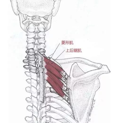 上背痛中背痛激痛點和肌肉疼痛按摩