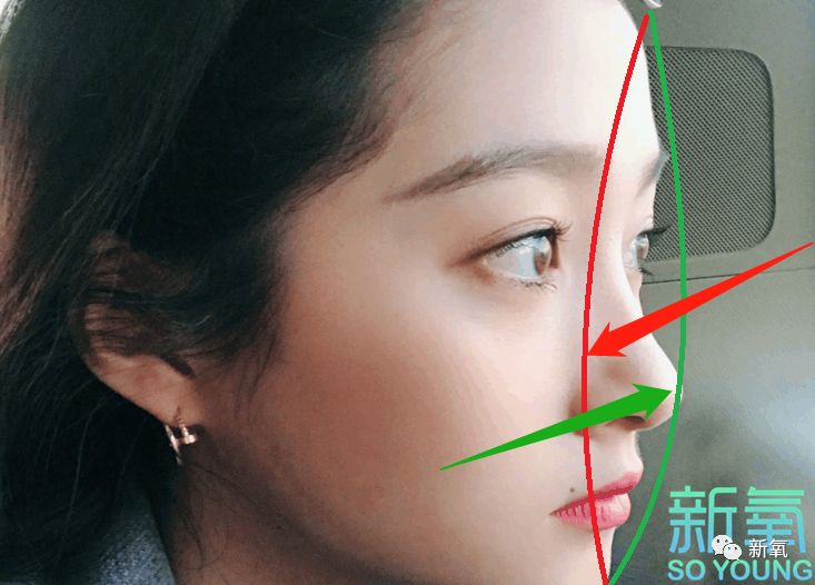 (好在她的鼻子够硬气,撑起了面中)如果凹面型再配上高度不够的鼻子