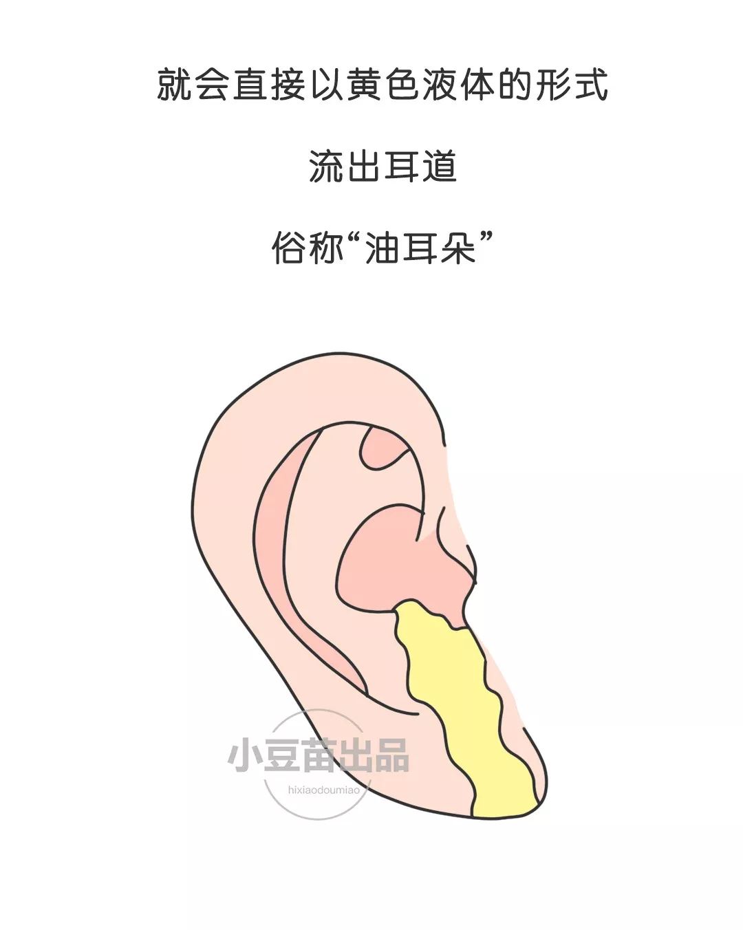 优生优育优教孩子耳屎到底要不要掏快一起来了解下