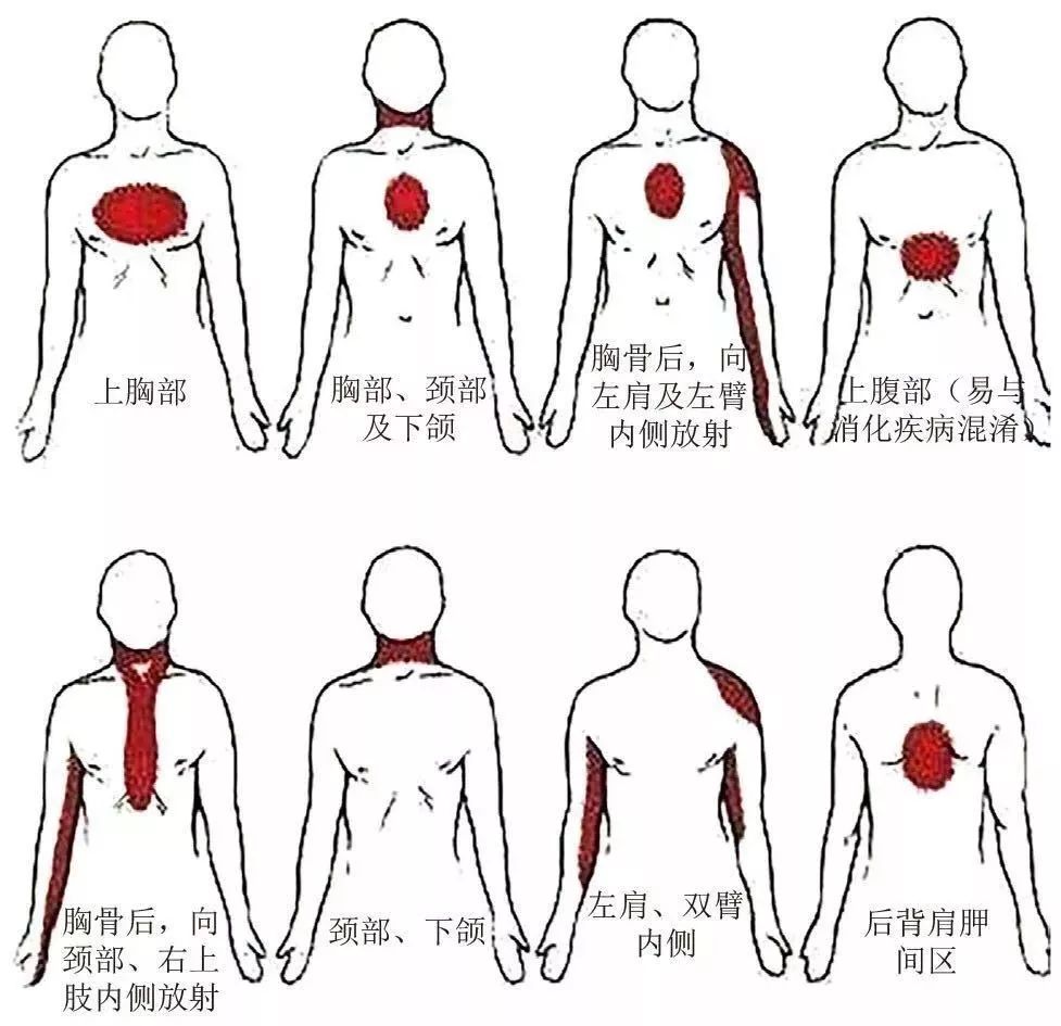 感,或胸憋,胸闷,时间