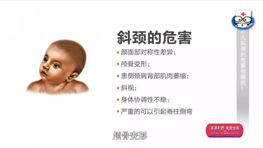 宝宝患有俗称歪脖子的「小儿斜颈.