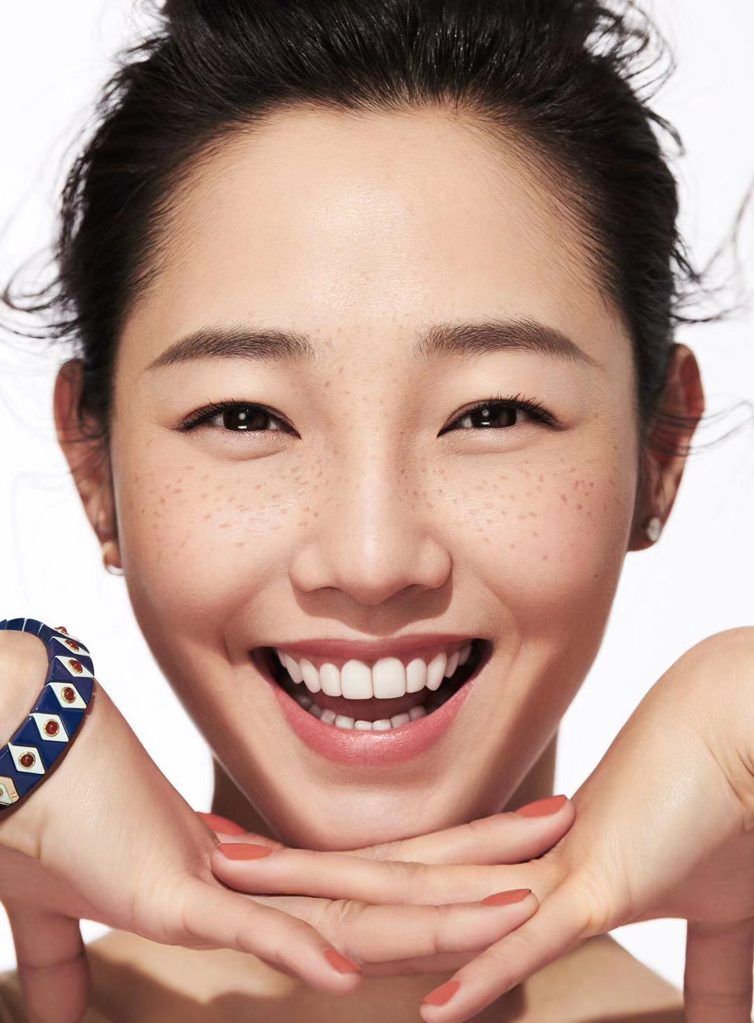 白百何俏皮雀斑妆力求还原真实自我展自信魅力