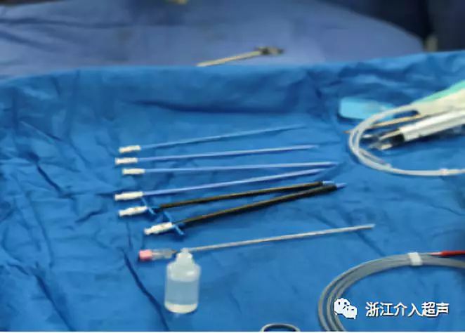 创新型胆道取石术---PTCS_胆管