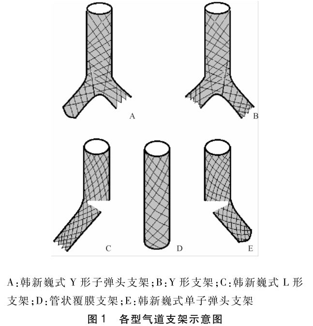 气管覆膜支架图片