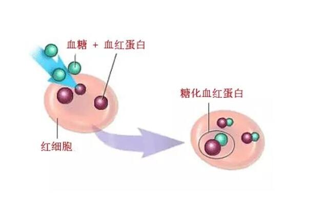 糖化血紅蛋白也是糖尿病的重要判斷依據之一,檢查的時候不受空腹的