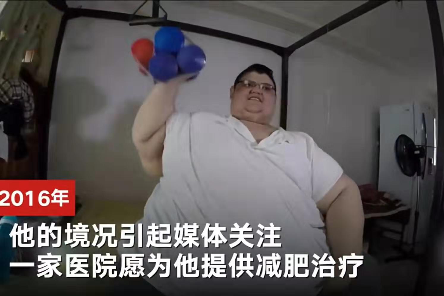 世界上最胖的人减重660斤能抬起胳膊的感觉真好