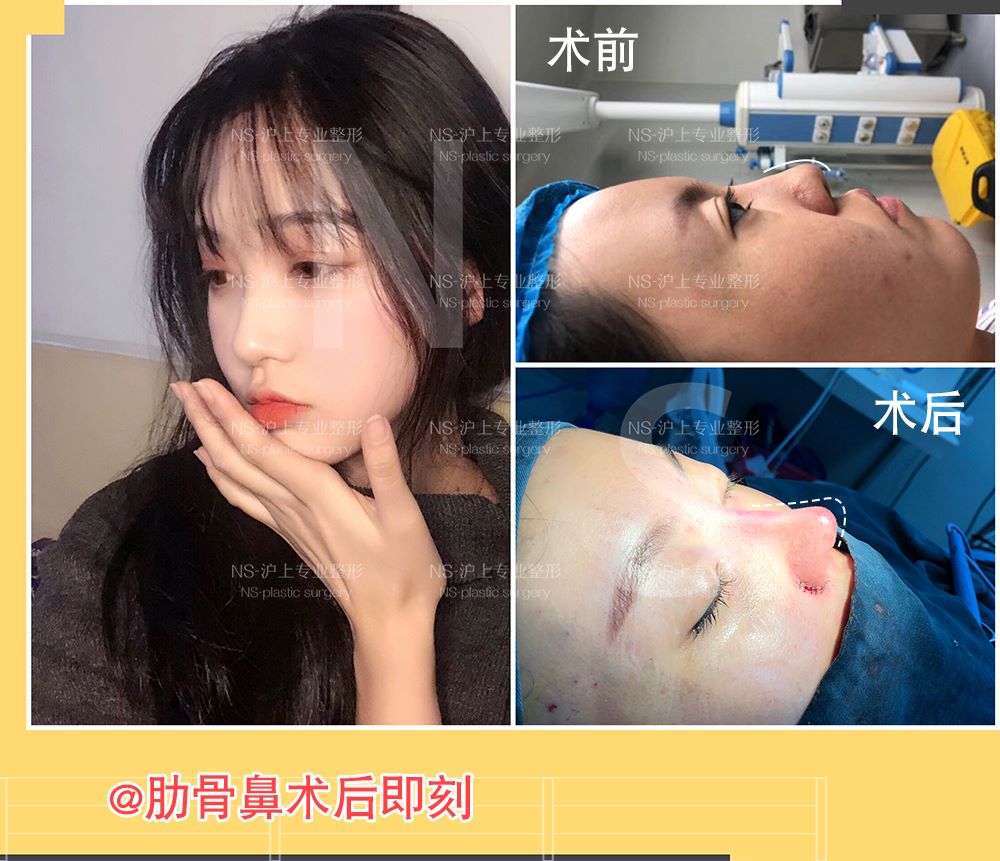 根据自身的基本,不能盲目整形,照葫芦画瓢不可取