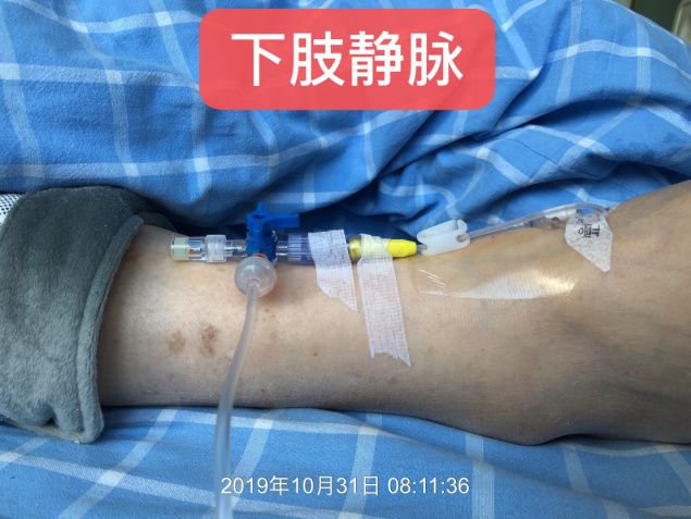 微泵给药,这5个细节问题不得不知!