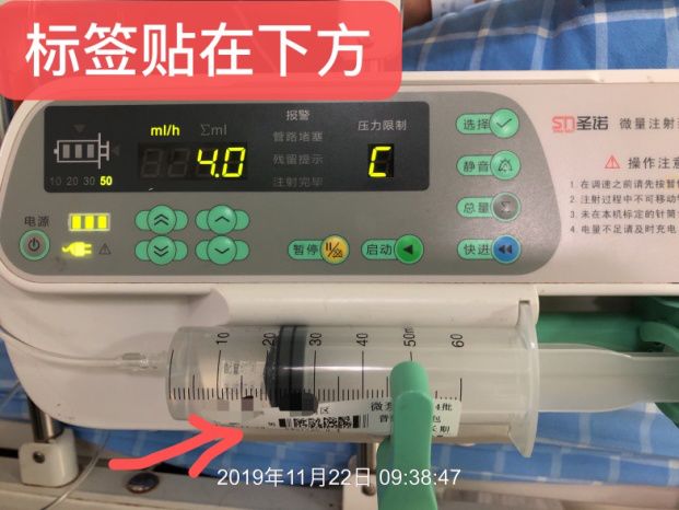 微泵给药,这5个细节问题不得不知!