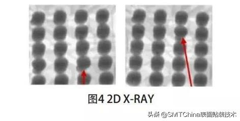 bga芯片枕头虚焊机理及工艺改善过程