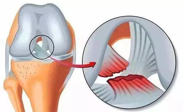 科学运动 防病治损 | 足球项目运动损伤防护工作坊向您发出邀请