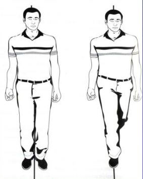 向一侧时则为 unterberger征阳性,临床意义等同于tandem romberg试验