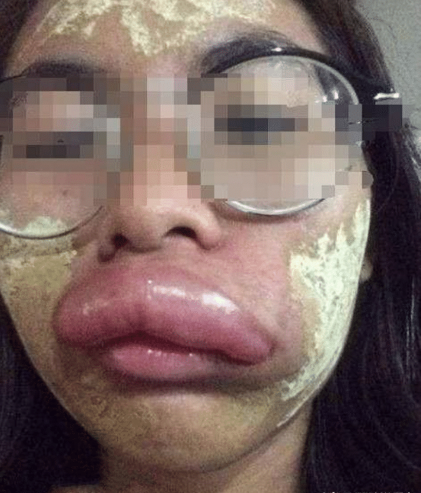 原创女子新婚之夜嘴肿成香肠,医生问诊,女子低头不语