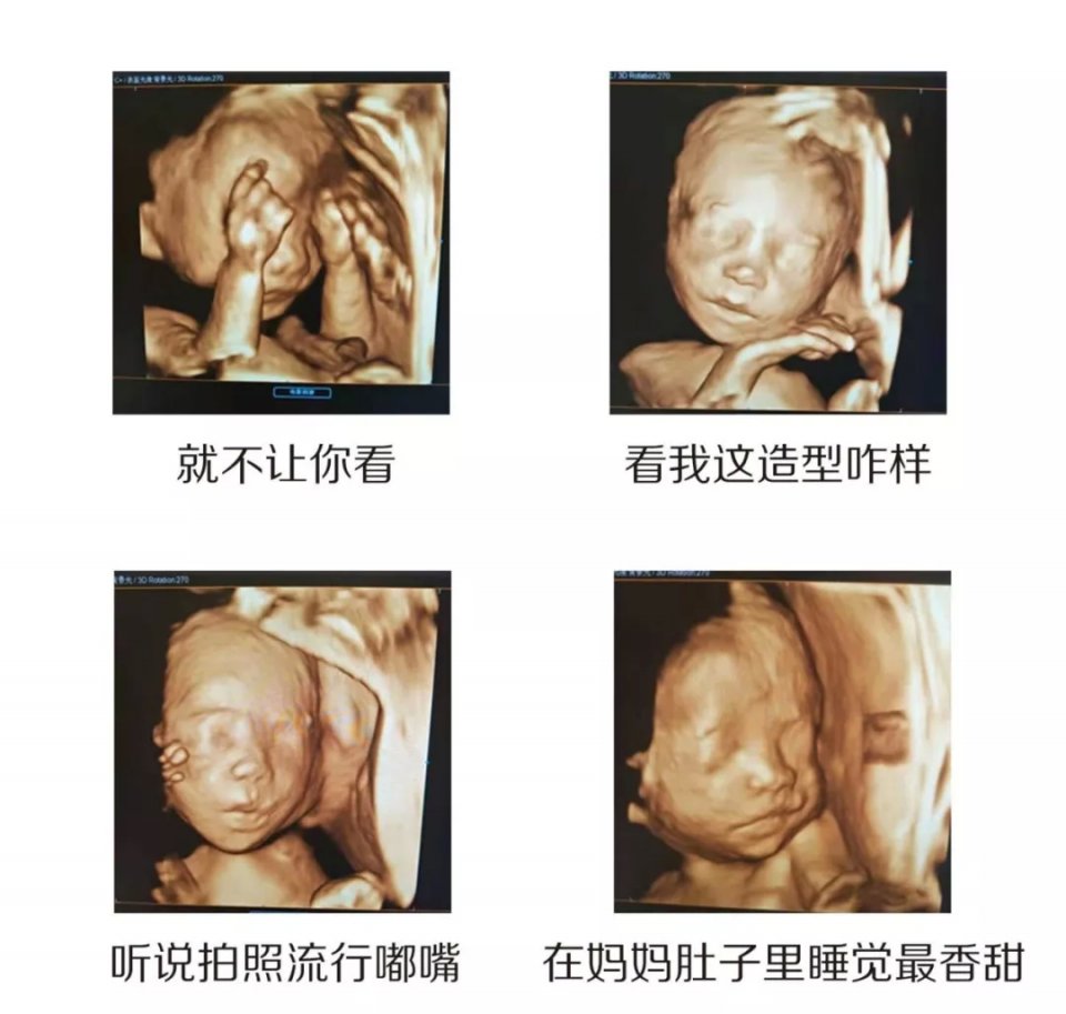 喜讯四维彩超升级啦首台5d彩超落户眉山蕴缨妇产医院