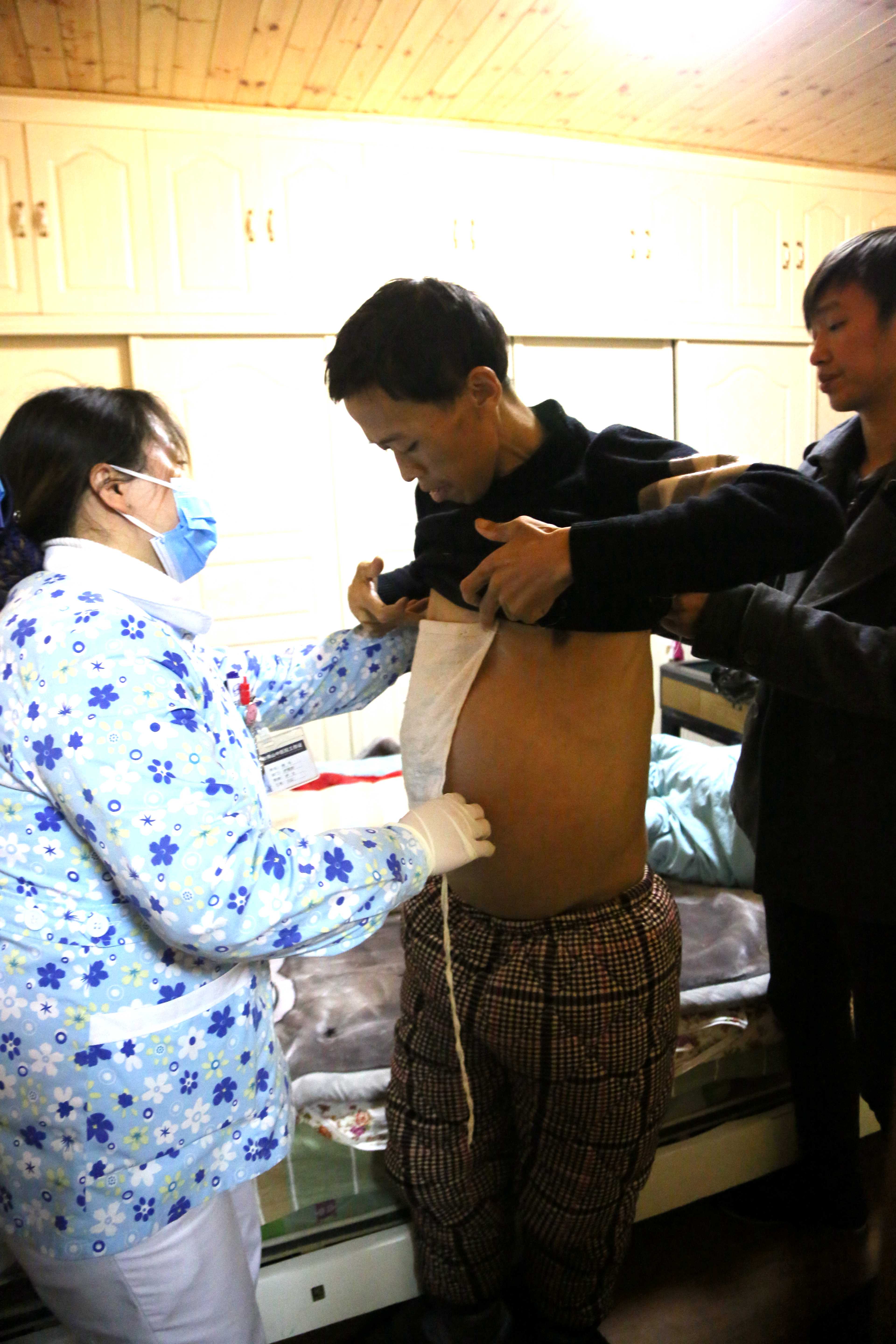 医护人员步行六公里为肝癌患者包敷中药贴