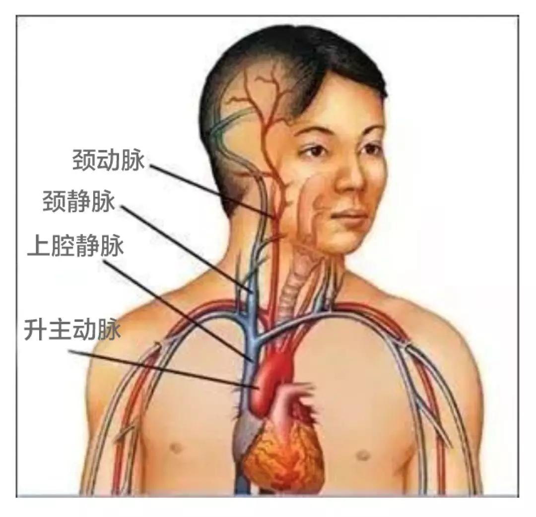 颈静脉压迫试验图片