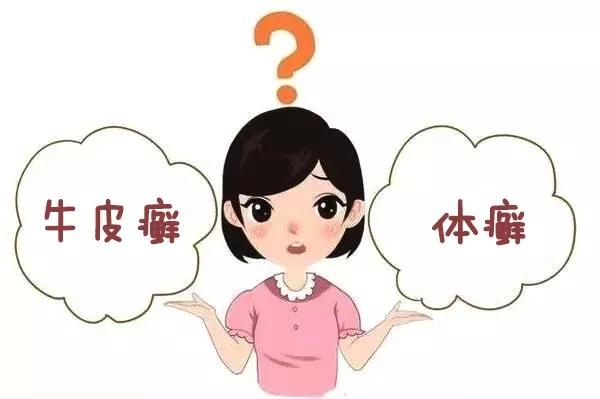 怎么辨别牛皮癣与体癣牛皮癣和体癣有什么不同