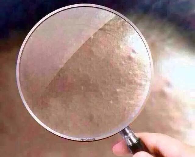 别乱补!身体的"小毛病"其实就在告诉你缺什么营养素哦