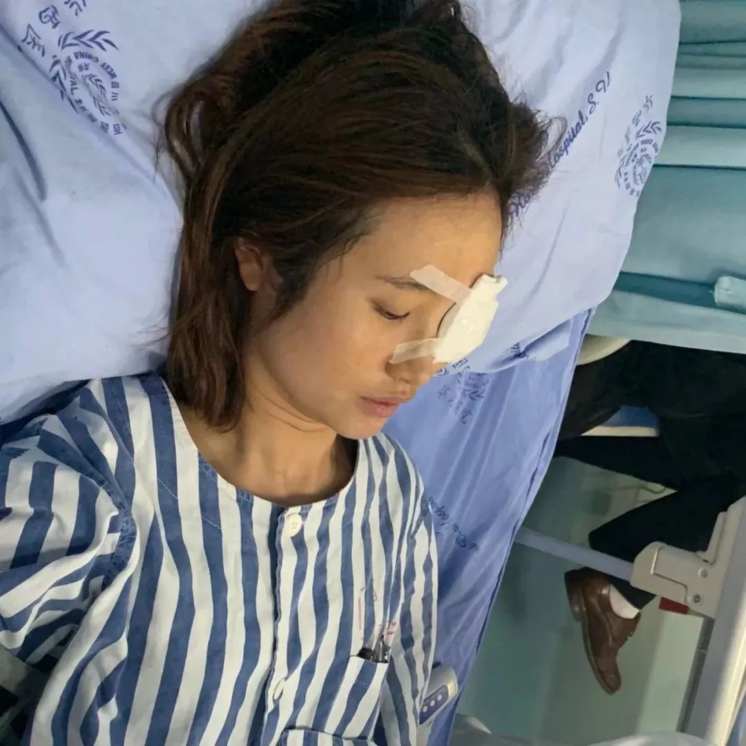 一周告别高度近视!真人记录 icl 眼部手术全过程