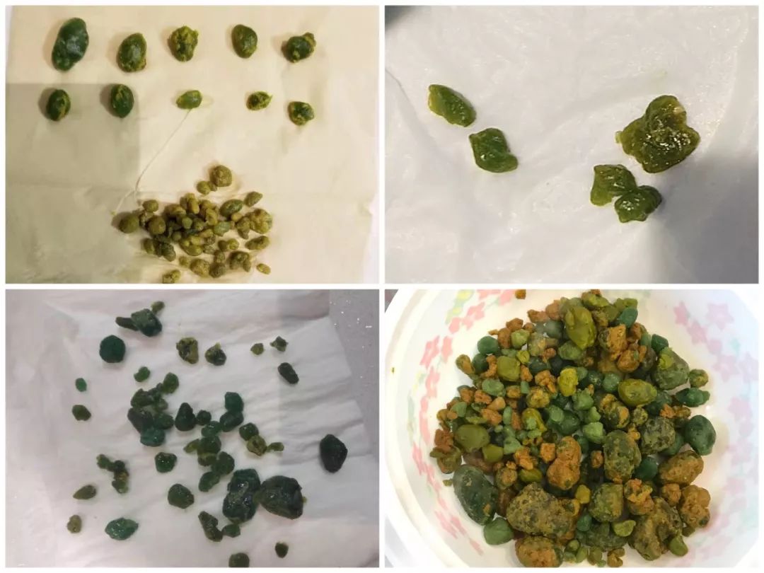 肝胆排毒营丨你真的应该和我们一起来