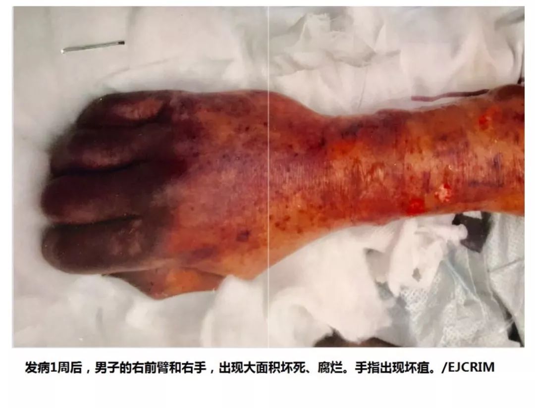 被狗舔了一口死了病因竟不是狂犬病