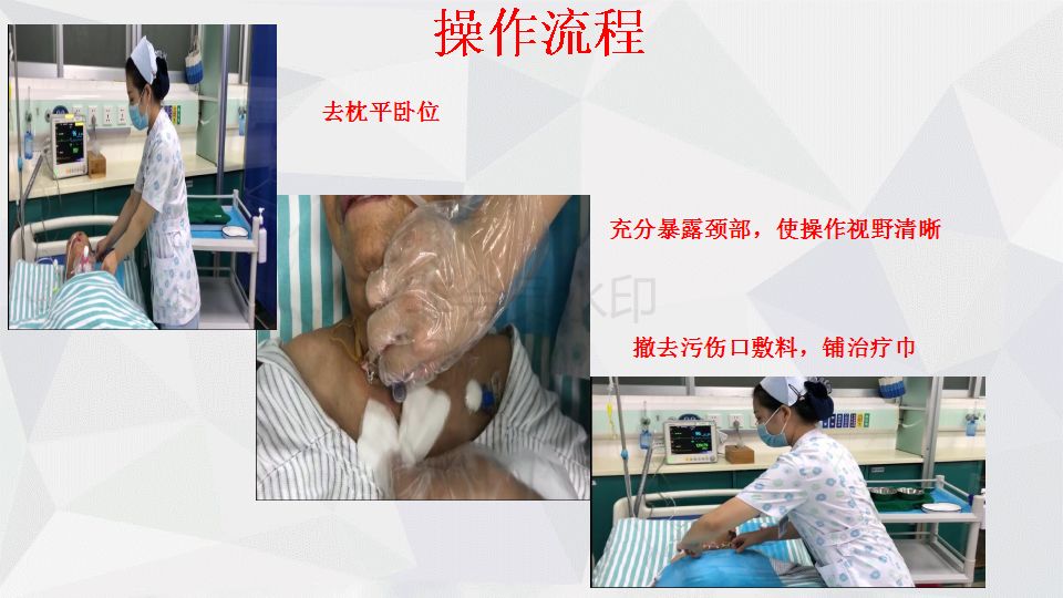 【ppt】气管切开换药(内附视频)_进行
