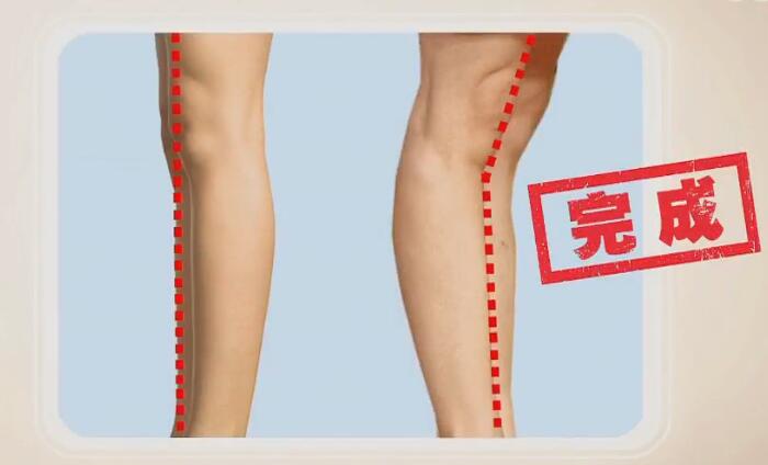 三项以上,就说明您可能存在全身性关节韧带松弛,患拇外翻的风险更大