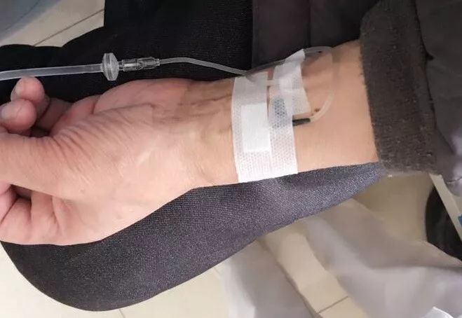 护士竟然倒着扎如此输液可行吗