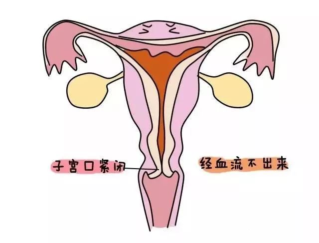 生完孩子大姨妈真就不再痛了吗?_子宫