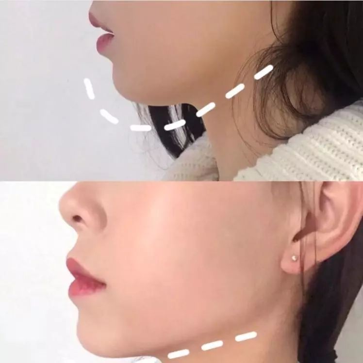 每天只花几块钱,2周告别大饼脸,解锁女明星偏爱的v字脸竟然这么简单!