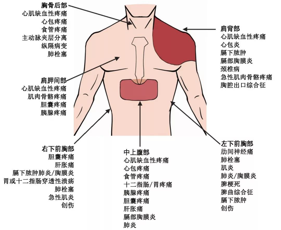 胸痛基层诊疗指南2019年来啦