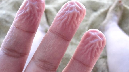 大家都知道,手指泡水后为什么会变皱? 是身体在暗示什么?