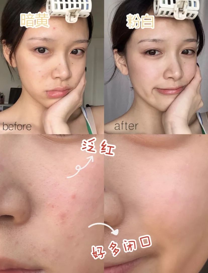 入冬皮肤干燥起皮暗黄试试爆款大补面霜一抹皮肤续命般水润白嫩