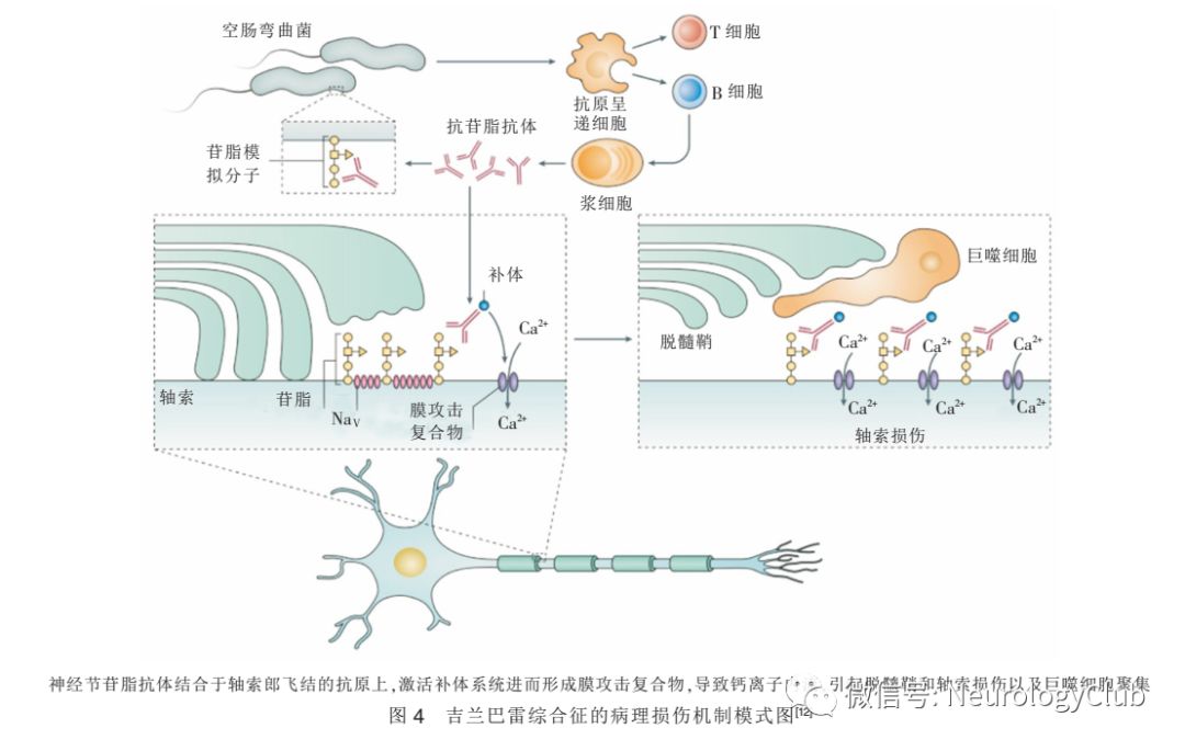 抗原内化或封闭引起的抗原表达减少或功能异常:这一机制常见于神经元