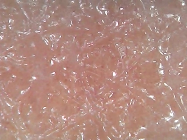 正常皮肤显微镜下图片图片