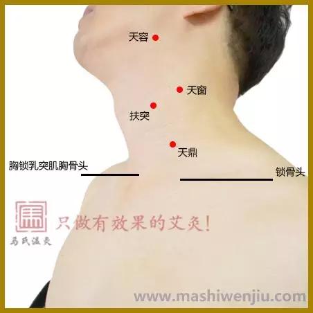 咳嗽老有痰怎么办如何艾灸