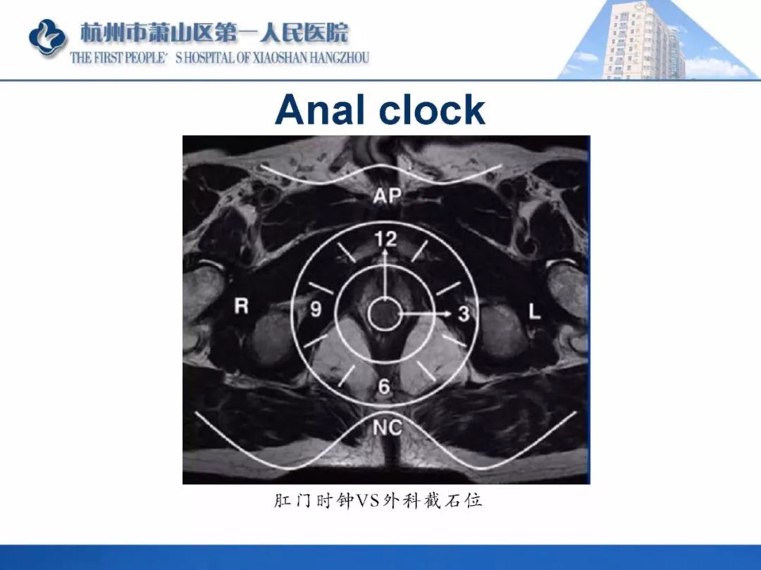 清晰版肛瘘的mri诊断