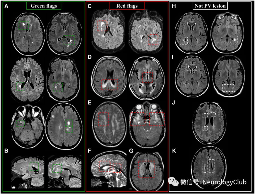 mri