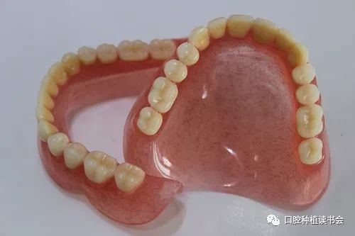 绝大多数牙列缺失颌患者可通过全口义齿(图2)来修复,但该修复方式仅能