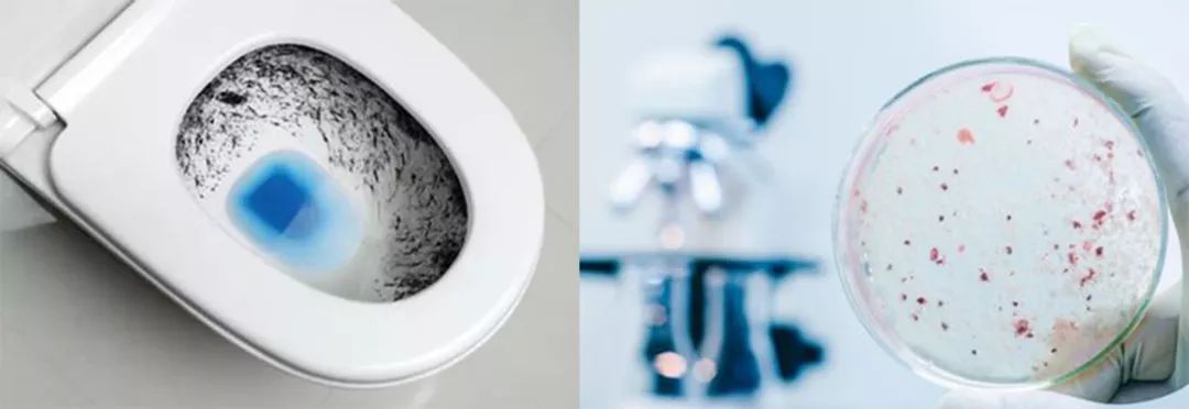 马桶尿渍发臭难洗用这招马桶立马清洁如新3年不用洗厕所