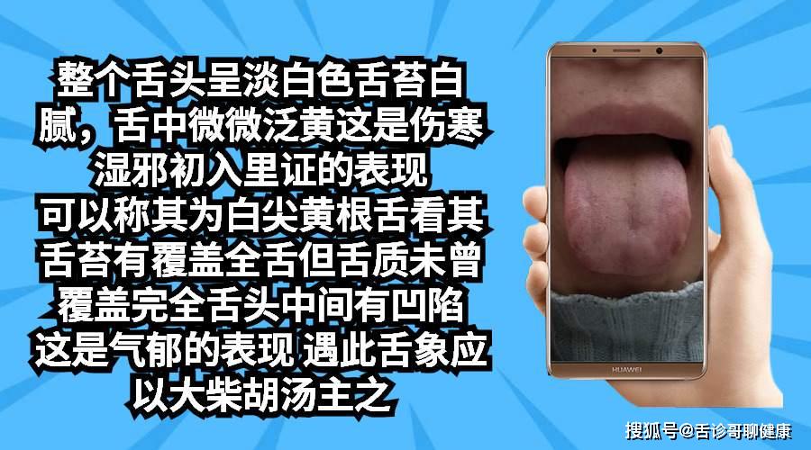 冠心病,記憶力減退,情緒低落等舌象的分析與感悟