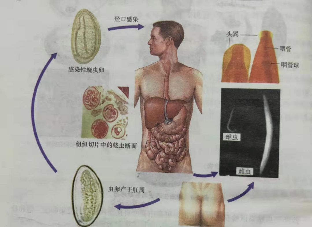 那么这个虫子到底是怎么进入到人体体内的呢?