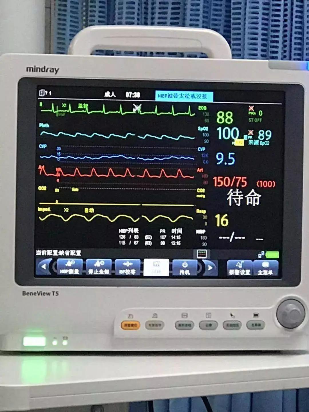 医者心,不言弃 ——触电男子心跳骤停1小时40分钟奇迹生还