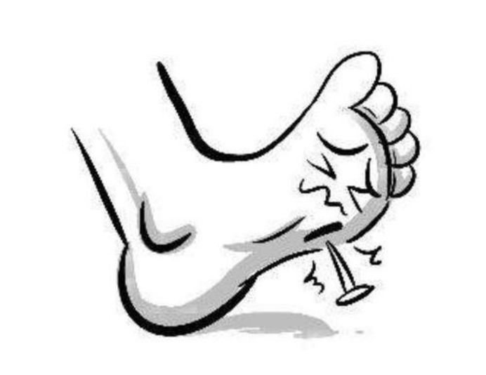 他踩了颗钉子半个月后突然嘴巴张不开了