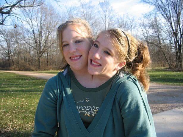 原创29岁美国连体姐妹会打垒球考出驾照当了老师还计划着结婚生子