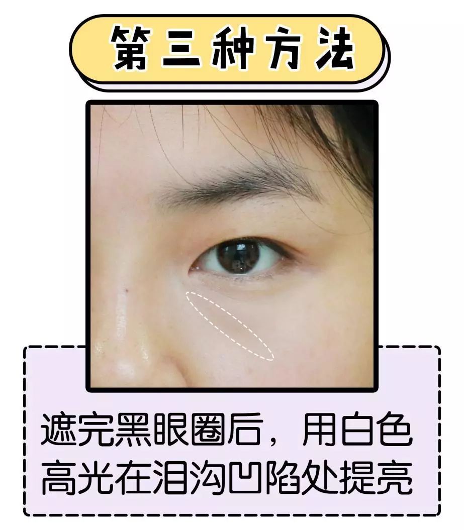 真人实测让黑眼圈泪沟痘印统统拜拜!_方法