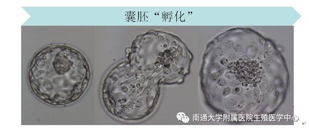 试管婴儿辅助孵化那些事儿
