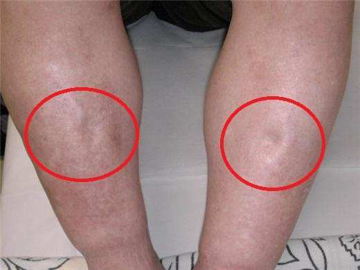 男人肾气不足,脚不会骗你!若脚上出现3种异常,提醒你及时养肾