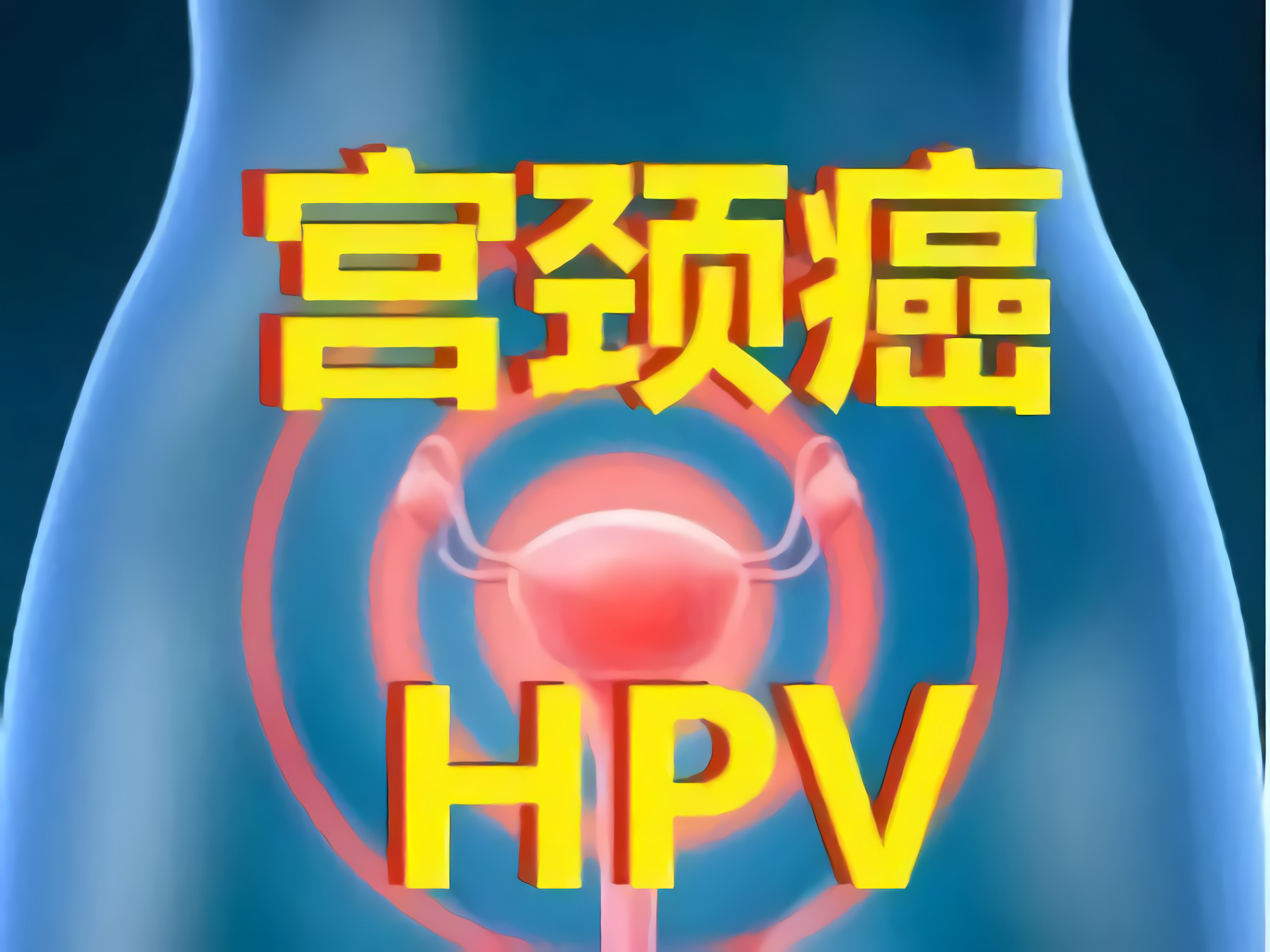 造成女性宫颈癌病发的罪魁祸首就是hpv病毒.